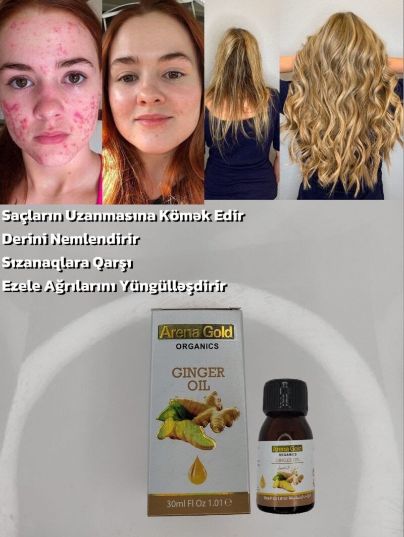 Arena Gold Ginger Oil qablaşdırması, məhsulun təbii zəncəfil tərkibini və saç tökülməsini azaldaraq, dərini gücləndirmə və masaj zamanı qan dövranını sürətləndirmə faydalarını vurğulayan dizayn. Yağ şüşəsi və qutusu təbii və sağlam təsir göstərən yaşıl və qəhvəyi rənglər ilə göstərilir.